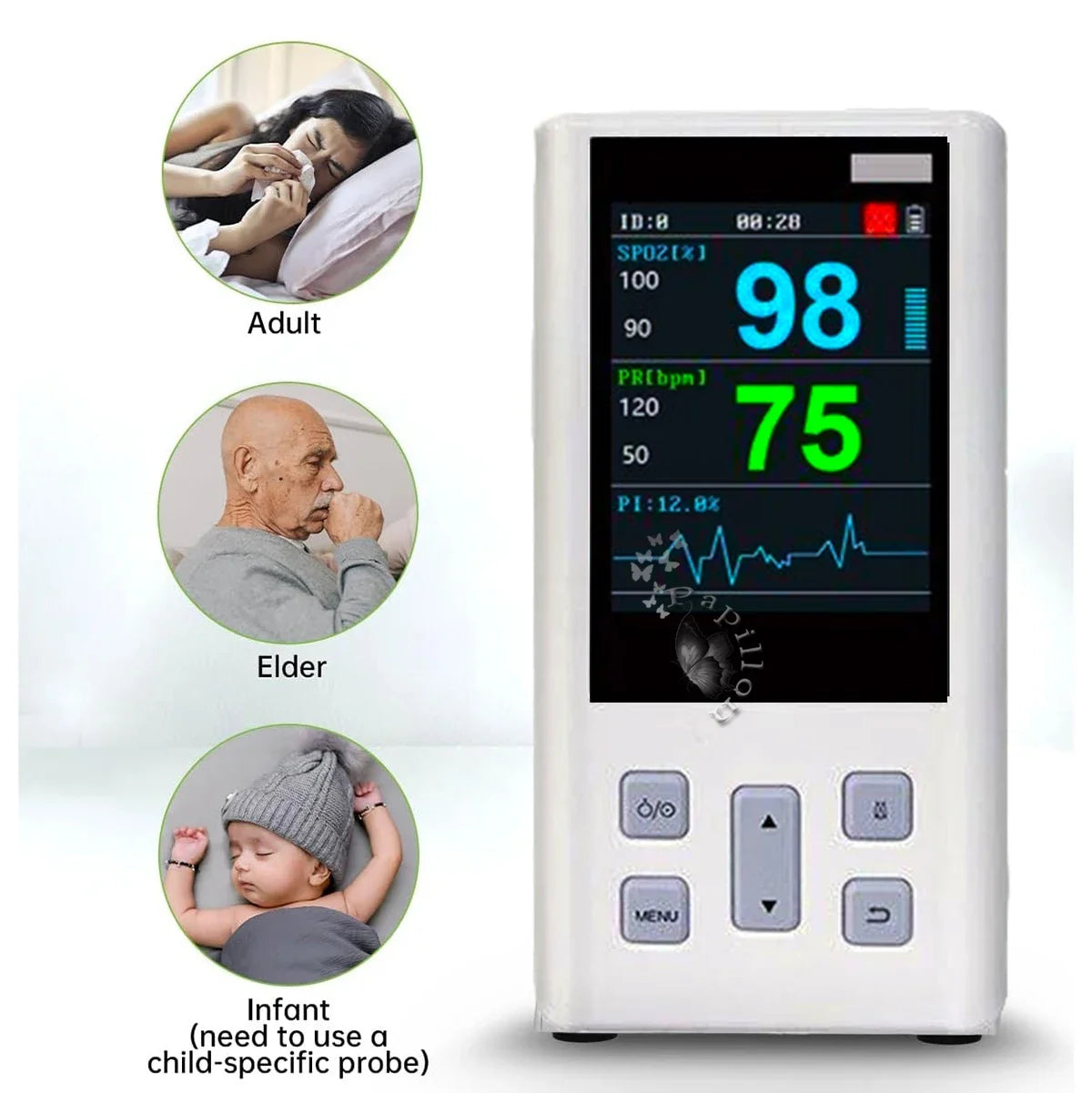 Pulse Oximeter Monitor for Heart Rate and Oxygen Saturation with Veterinary Medical