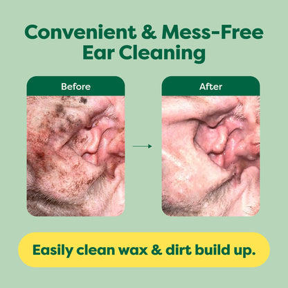 Earth Rated Pet Ear Wipes for Dogs & Cats in Canada